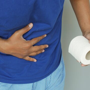 How to Prepare for Colonic Irrigation: A Step-by-Step Guide for Constipation Relief